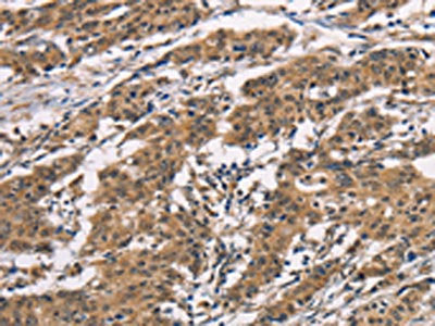 BAI1 Antibody
