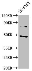 CSNK1E Antibody