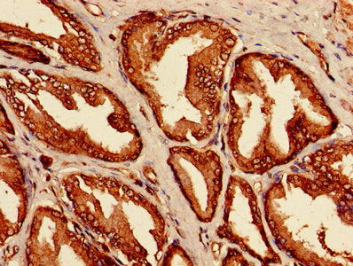 LRRFIP1 Antibody