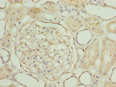 LRRN2 Antibody