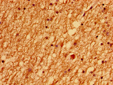 LSM1 Antibody