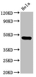 CSNK1E Antibody