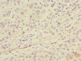 LSS Antibody