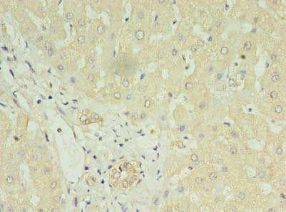 LYRM1 Antibody