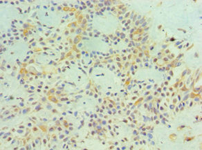 MAGEA1 Antibody