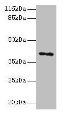 MAGEA10 Antibody