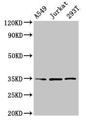 MAGEA3 Antibody