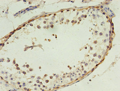 MAGEA4 Antibody
