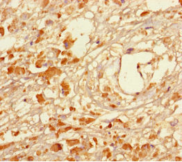 MAGEA5 Antibody