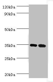 MAGEA6 Antibody