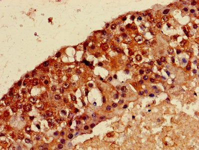 MAGEA8 Antibody