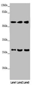 MAOB Antibody