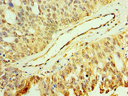 MAP2K3 Antibody