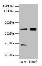 MAP2K3 Antibody