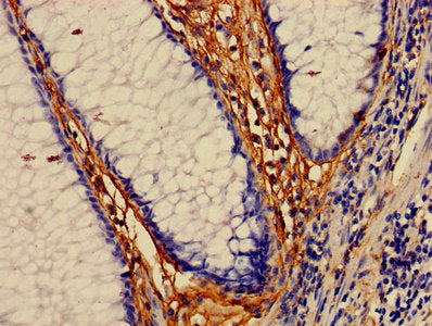 MAP3K7 Antibody