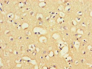MAP3K8 Antibody