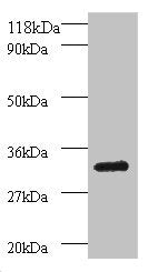 PSMB7 Antibody