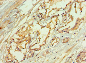 LAMTOR3 Antibody