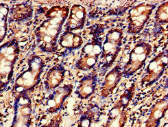 MARK3 Antibody