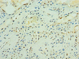 MAS1 Antibody