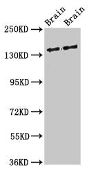 MAST3 Antibody