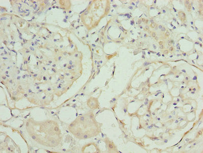 MAT2A Antibody