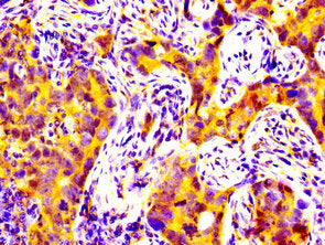 MATN2 Antibody