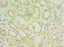 MATN3 Antibody