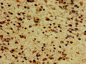 MC5R Antibody