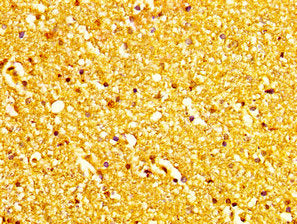 MCHR2 Antibody