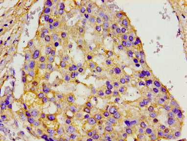 MCM3AP Antibody
