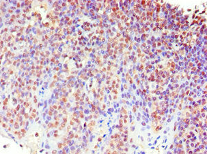 MECP2 Antibody