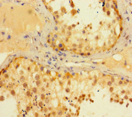 MEN1 Antibody