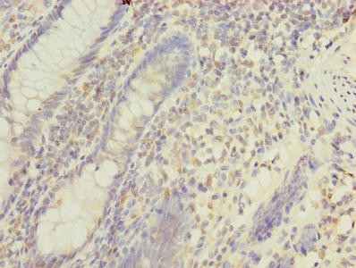 MFAP3L Antibody