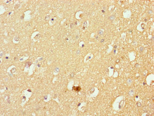 MFSD11 Antibody