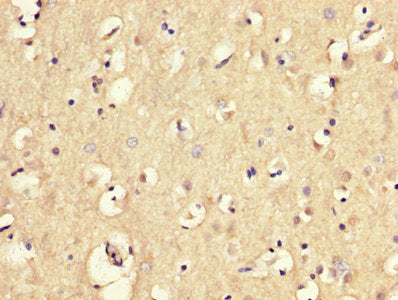 MGP Antibody