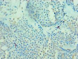 MICA Antibody