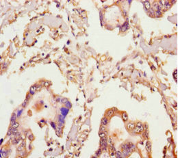 MICAL2 Antibody