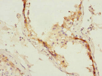 MID1 Antibody