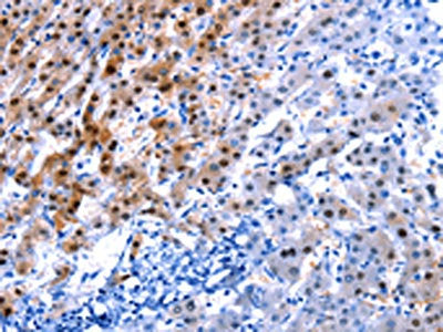 IL2RA Antibody