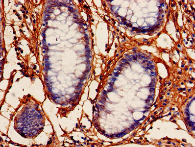 PFDN5 Antibody