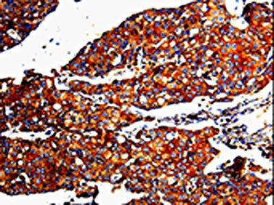 MMP3 Antibody