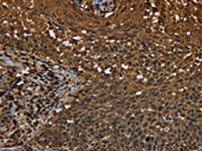 MYBBP1A Antibody