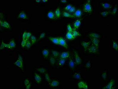 MMGT1 Antibody