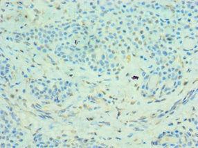 MMP14 Antibody