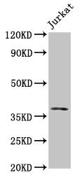 MOS Antibody