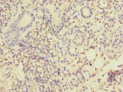 MPPED1 Antibody