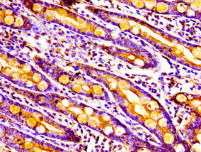MPST Antibody