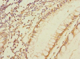 MPZL2 Antibody