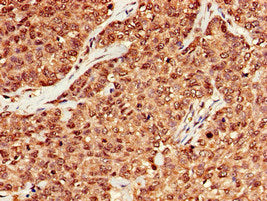 MRE11A Antibody